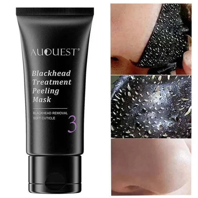 Blackhead remover acne treatment mask
